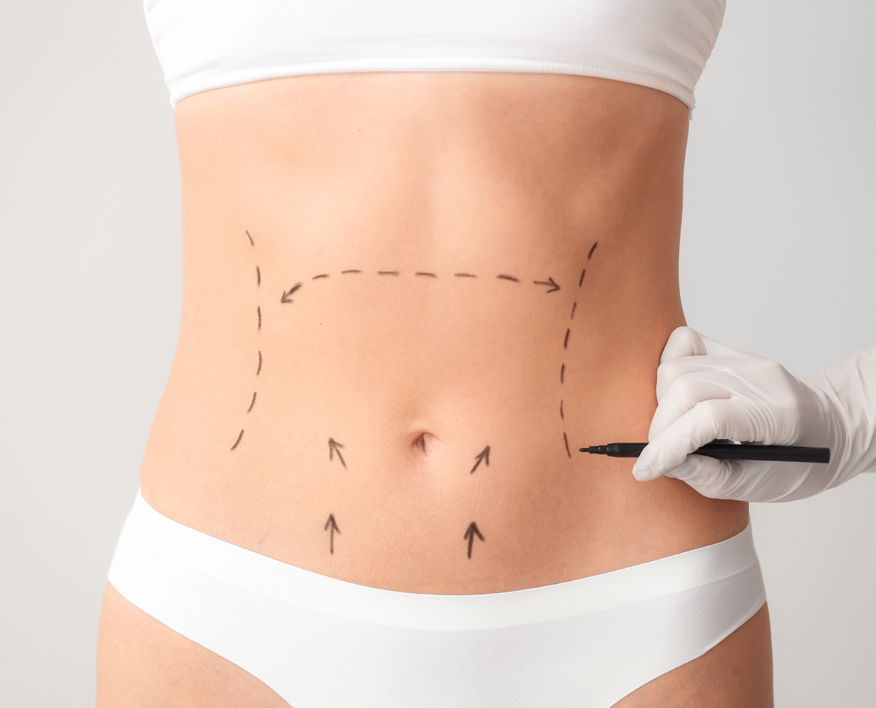 Abdominoplasty - The Plastic Surgery Clinic