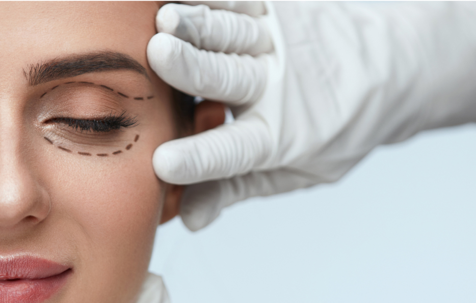 Blepharoplasty - Plastic Surgery Clinic