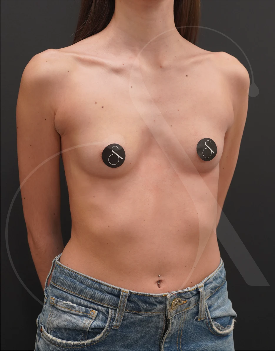 plastic-surgery-clinic-case-study-augmentation-1-1