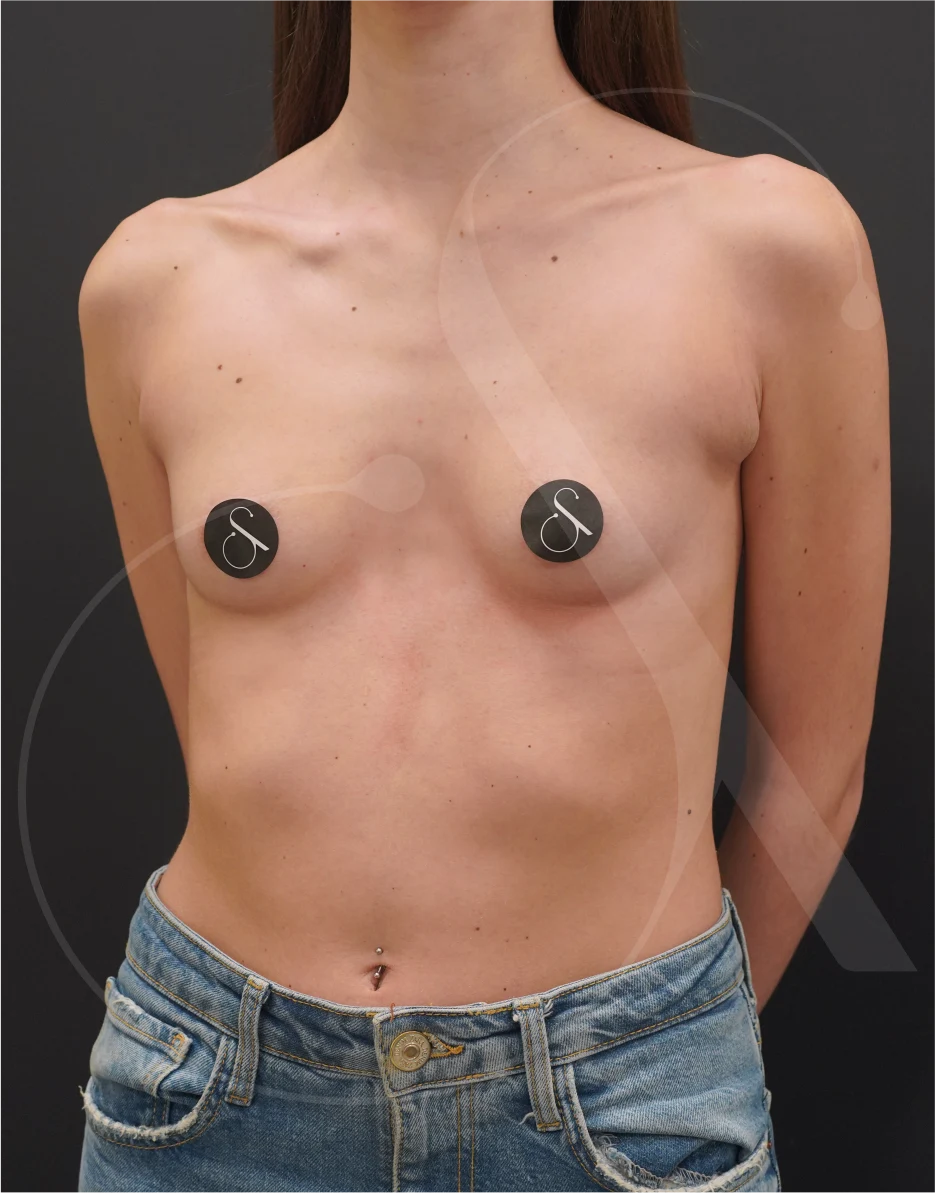 plastic-surgery-clinic-case-study-augmentation-1-3