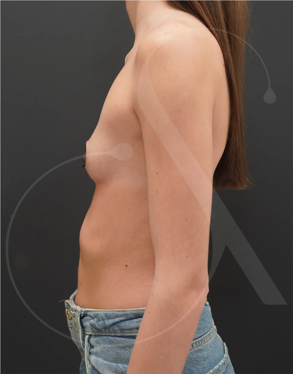 plastic-surgery-clinic-case-study-augmentation-1-5