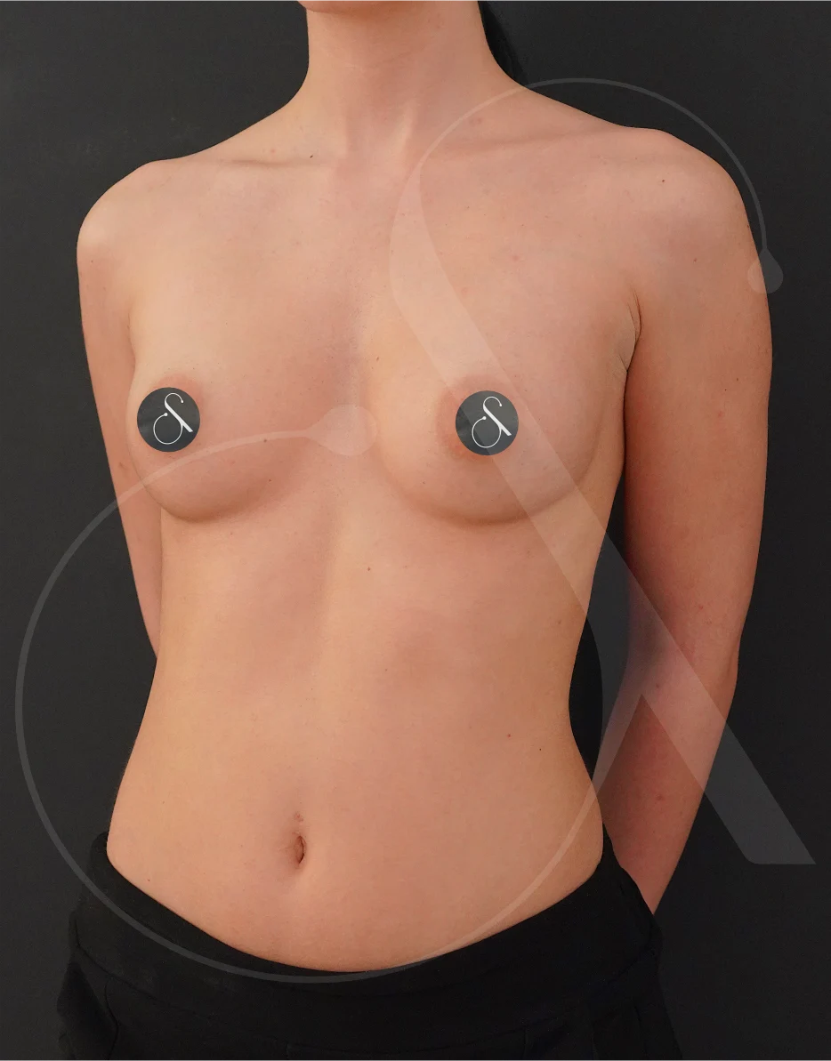 plastic-surgery-clinic-case-study-augmentation-2-1