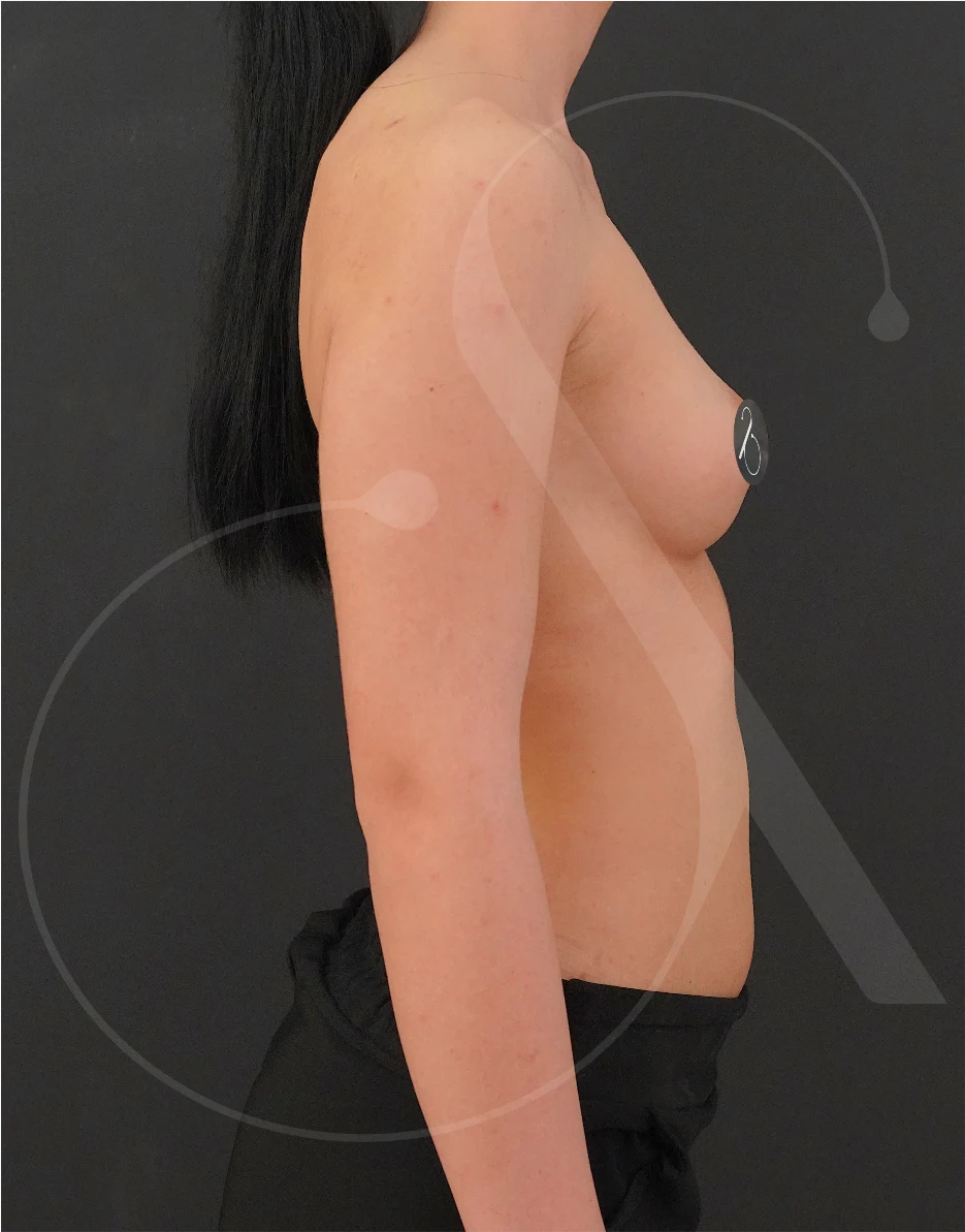 plastic-surgery-clinic-case-study-augmentation-2-7