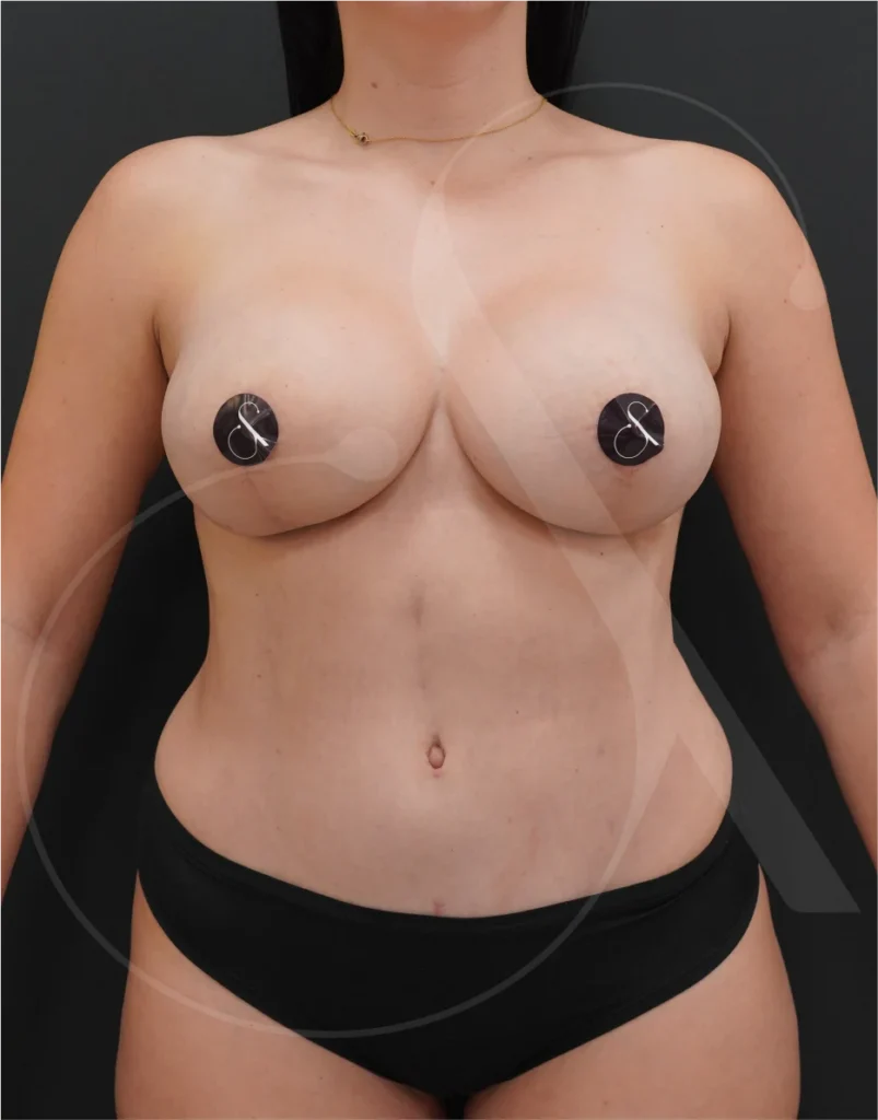 plastic-surgery-clinic-case-study-mmo-1-10