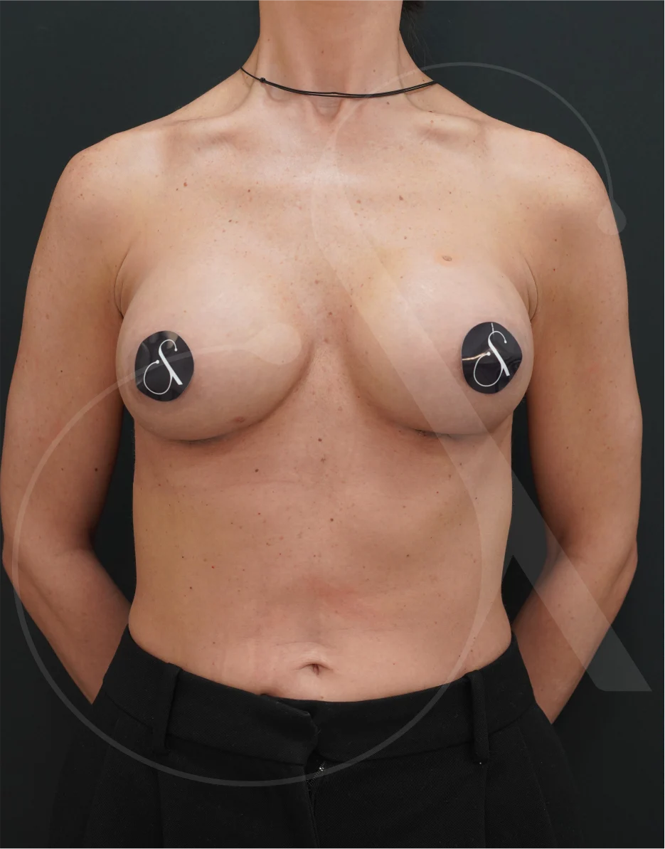 Preservé – Case 01