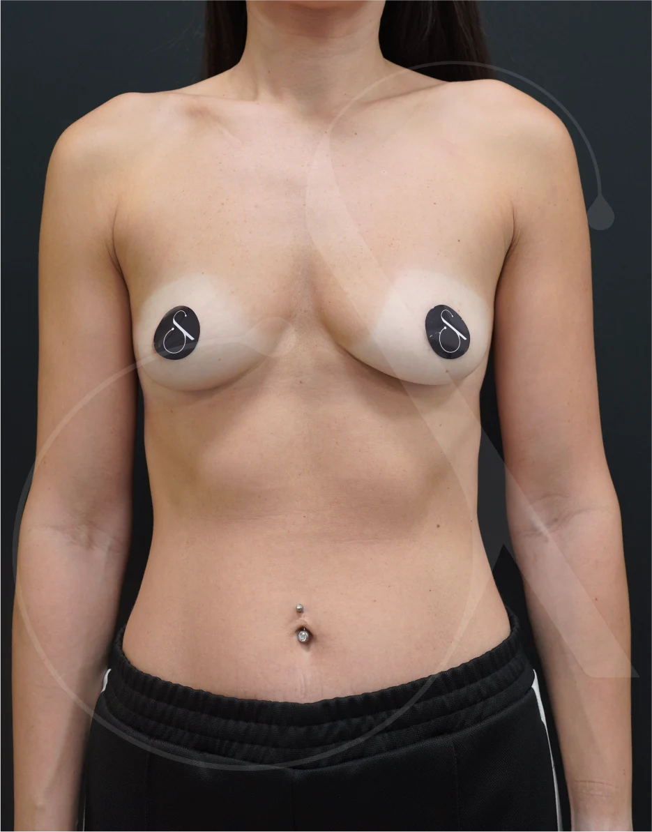 Preservé – Case 02