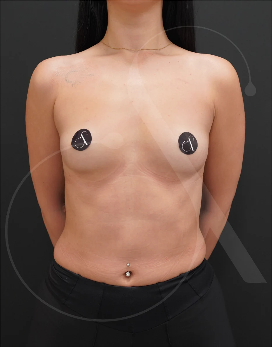 Preservé – Case 04